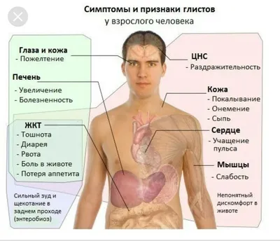 Аскаридоз: лечение, симптомы, возбудитель, как заразиться