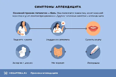 Как распознать аппендицит? | Вільне радіо