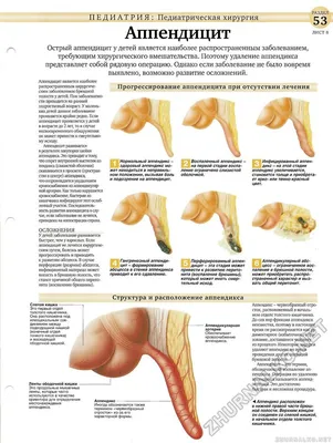Аппендицит: симптомы у взрослых и детей | Диагностика и лечение аппендицита  в АО «Медицина»