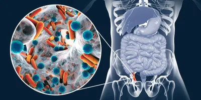 Аппендикулярный инфильтрат – причины, симптомы, диагностика и лечение  заболевание у взрослых | «Будь Здоров»