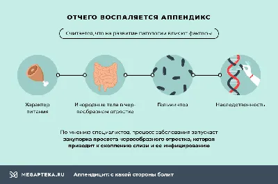 Аппендицит: симптомы, признаки, с какой стороны болит, операция по  удалению, как определить