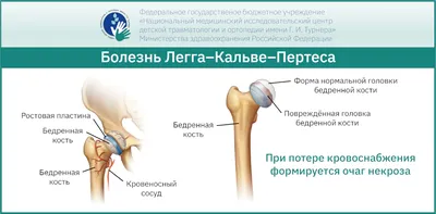 Каждый 20 человек на земле имеет орфанное заболевание: что нужно знать о  редких болезнях | Лечение в Израиле. Клиника «Хадасса» | Дзен