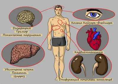 40 переломов за 13 лет. Как живут в России «хрустальные люди»? — Новая  газета