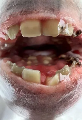 Новости науки: - Существо с человеческими зубами выловили моряки из  Индонезии - кадры - 06.04.2018 | Диалог.UA