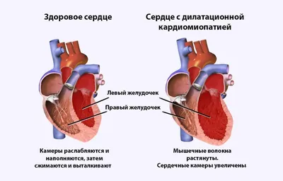 Сердце курящего человека фото фотографии