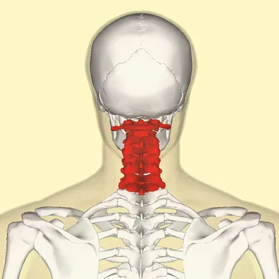 Цервикалгия (боль в шее) - лечение, симптомы, причины, диагностика | Центр  Дикуля
