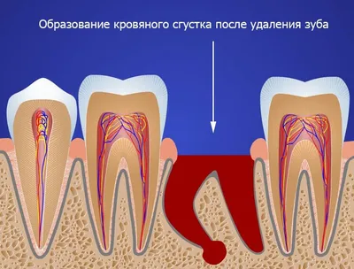 Воспаление под языком | Семейная стоматология