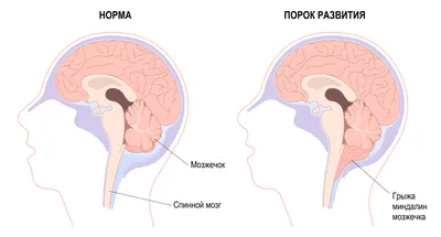 Нервная система — Википедия