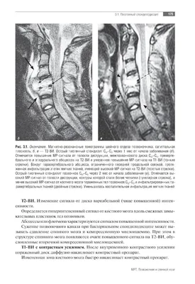 Спинной мозг улетел» — создано в Шедевруме