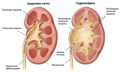 Три почки у человека фото