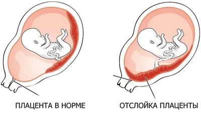 Как развивается ребёнок: фотограф показал волшебный процесс появление новой  жизни на свет (23 фото) » Невседома