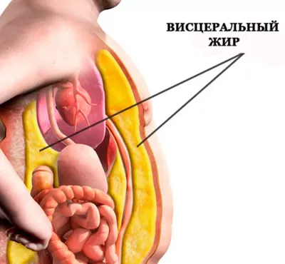 Чем опасен висцеральный жир?