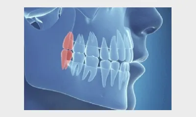 Медицинский плакат \"Зубы человека\" - 1002251 - VR6263L - ZVR6263L - Dientes  - 3B Scientific